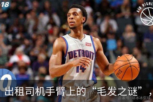 出租司机手臂上的“毛发之谜”，竟是个笑话